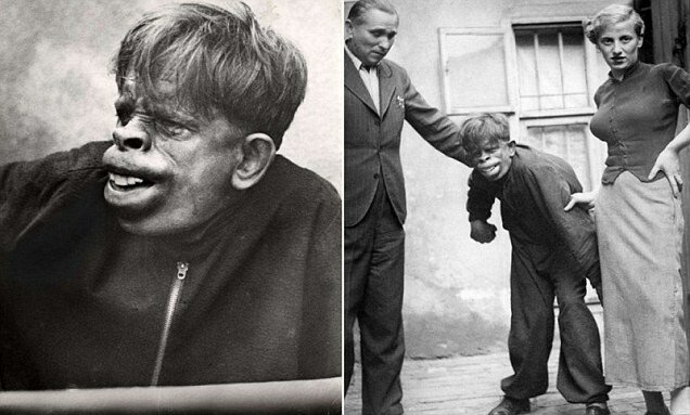 S-a aflat adevarul despe OMUL MAIMUTA dupa 75 de ani! FOTO SOCANT