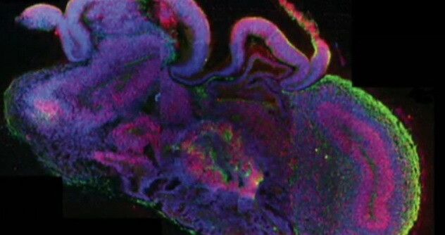 "Realizarea este uimitoare si fascinanta" Creier uman in miniatura, obtinut in laborator: VIDEO