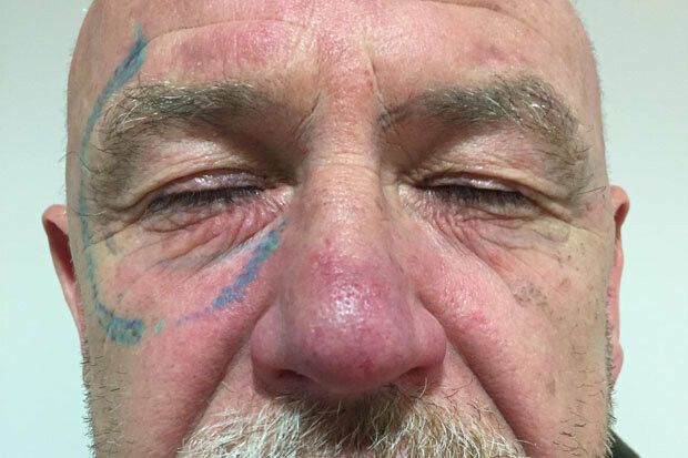 Hangover 4! Ce si-a tatuat un barbat pe fata dupa o noapte de pomina