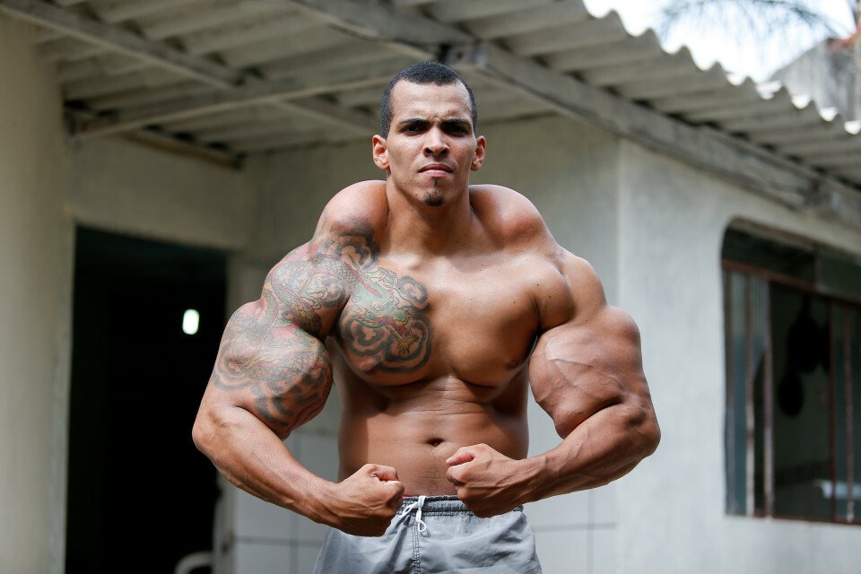 Brazilianul dependent de injectii cu ulei, poreclit Incredibilul Hulk, isi spune povestea