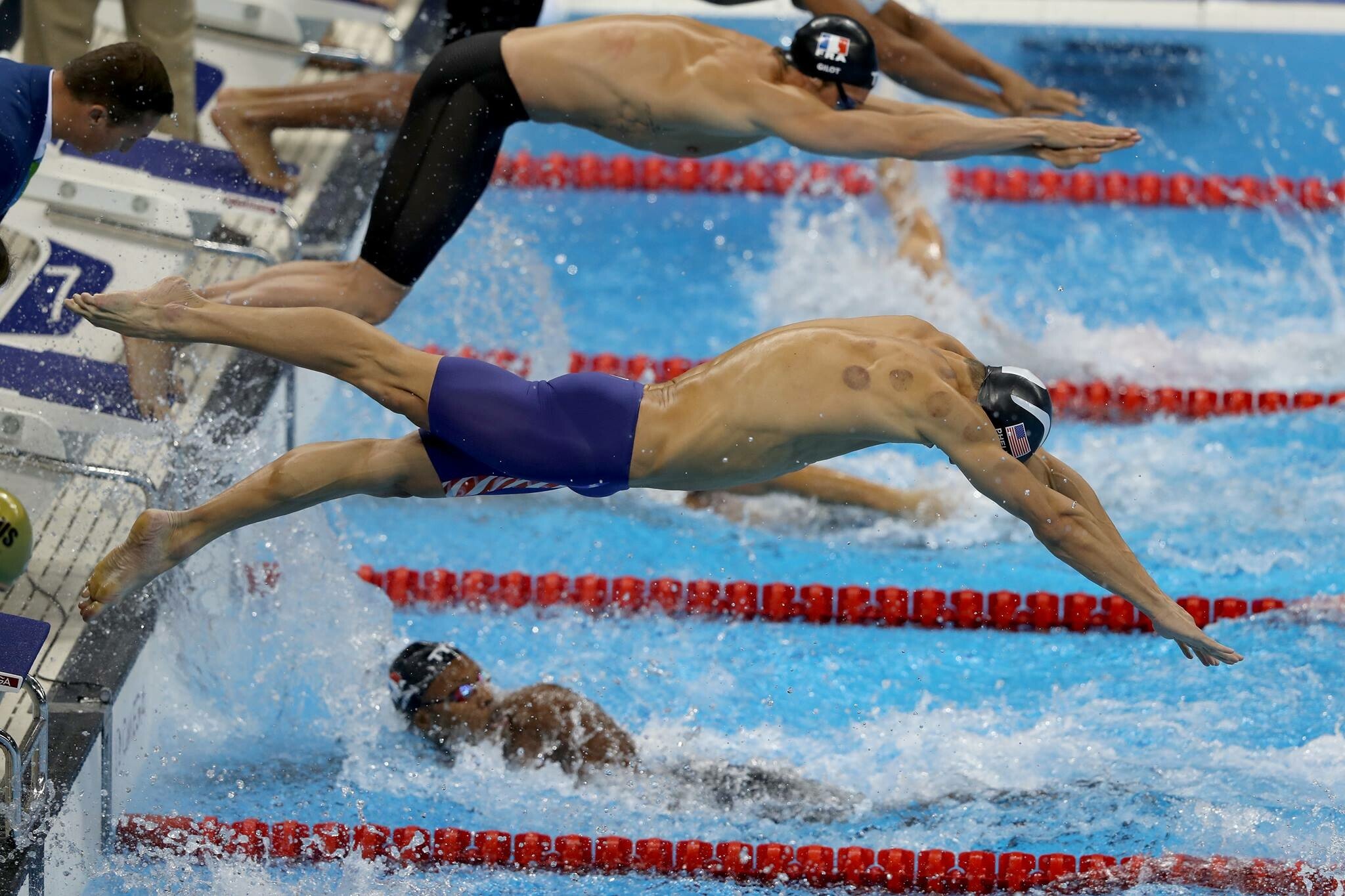 Toata lumea a observat petele rosii de pe spatele lui Michael Phelps! Ce sunt aceste semne