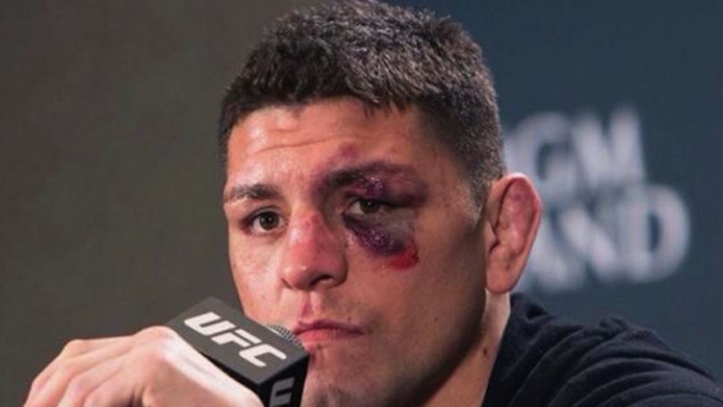 Patru barbati l-au atacat pe luptatorul din MMA, Nick Diaz, intr-un club: "Nu cred ca stiau ei cine sunt!"