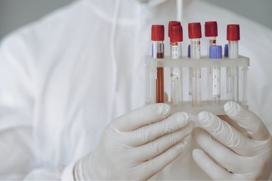 (P) Analize și investigații medicale pe care ar fi bine să ți le faci anual