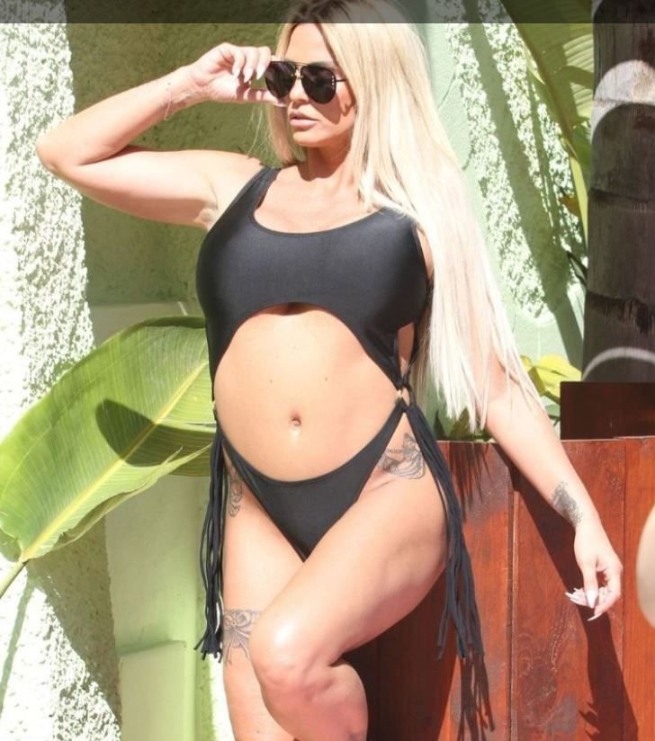 Katie Price, mulțumită de cum arată după o nouă intervenție la nivelul feței